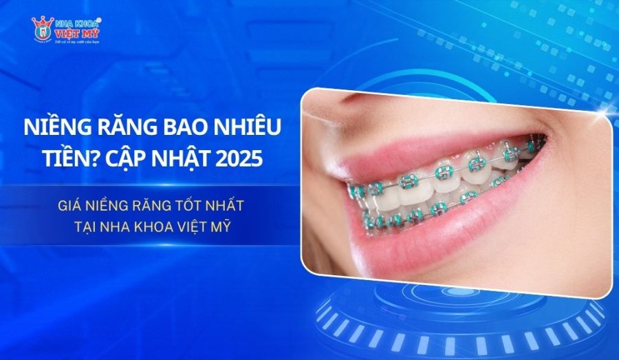 Niềng răng tốn bao nhiêu tiền