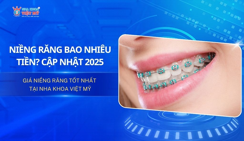 Niềng răng tốn bao nhiêu tiền