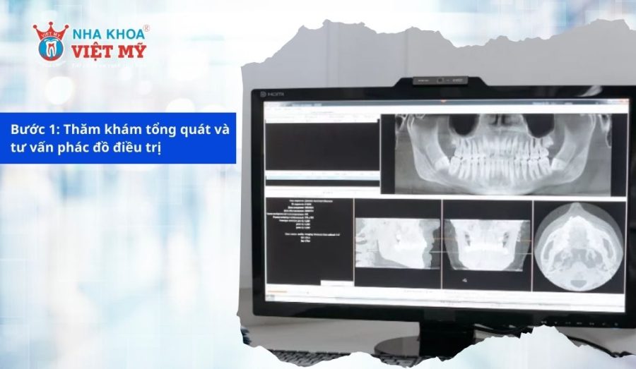 Chụp X-quang là một trong các bước của quy trình bọc răng sứ cho răng sâu Chụp X-quang là một trong các bước của quy trình bọc răng sứ cho răng sâu