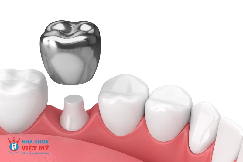 Tái khám định kỳ 6 tháng/lần