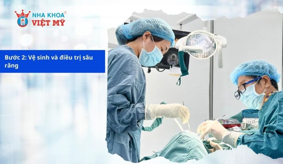 Vệ sinh và điều trị sâu răng trước khi tiến hành bọc sứ cho răng sâu Vệ sinh và điều trị sâu răng trước khi tiến hành bọc sứ cho răng sâu