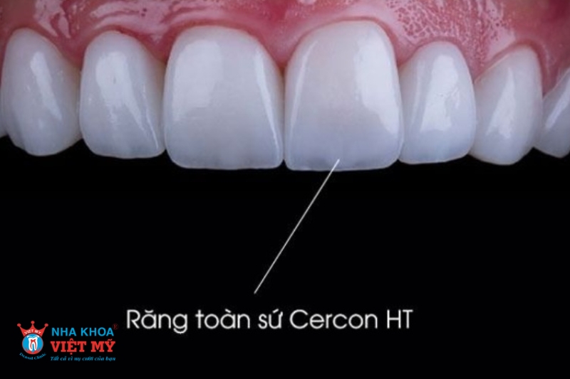 Răng sứ Cercon HT