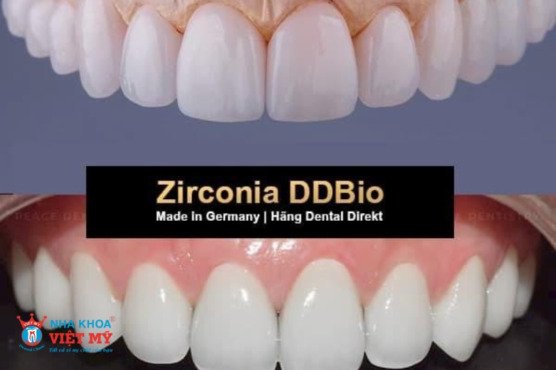 Răng sứ Zirconia DDBio