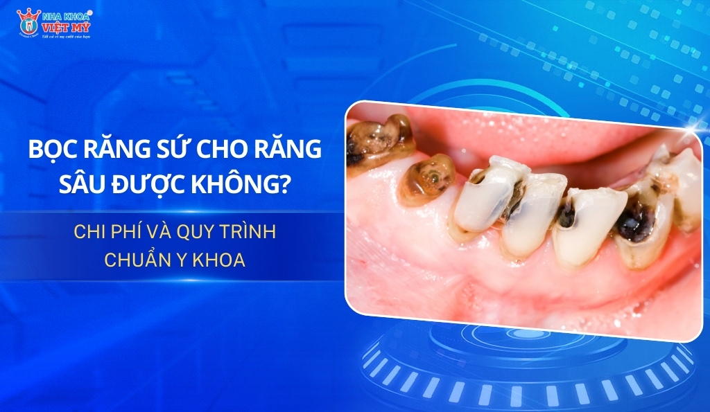 thumbnail bọc răng sứ cho răng sâu được không