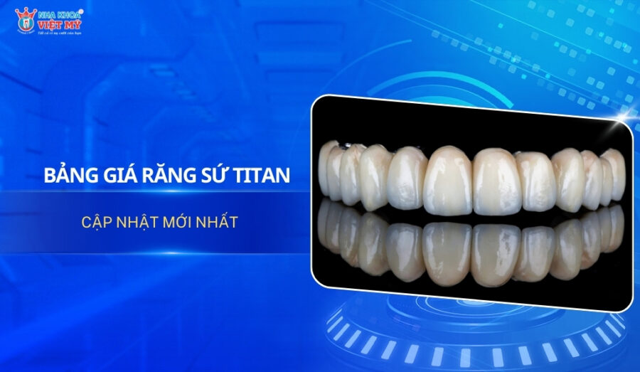 thumbnail giá răng sứ Titan