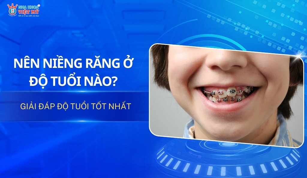 thumbnail niềng răng ở độ tuổi nào