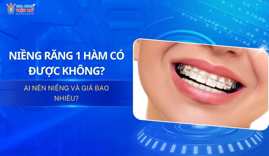 thumbnail niềng răng 1 hàm có được không