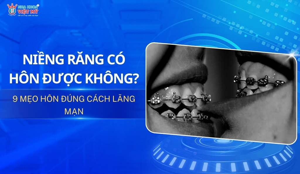 thumbnail niềng răng có hôn được không