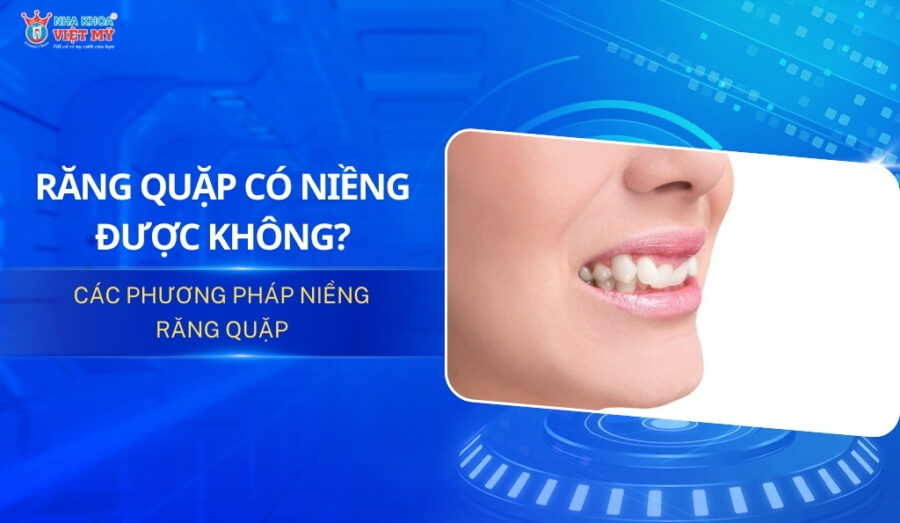 thumbnail răng quặp có niềng được không