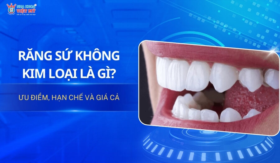 thumbnail răng sứ không kim loại là gì