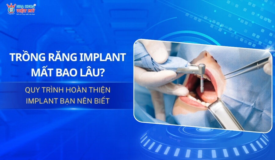 thumbnail trồng răng implant mất bao lâu