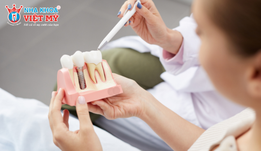 Tái khám sau cấy ghép để bác sĩ kiểm tra độ tích hợp của trụ Implant