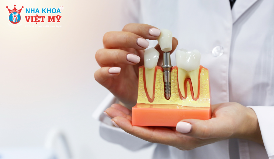 Sau trồng răng Implant, nên ăn thức ăn mềm, dễ nhai