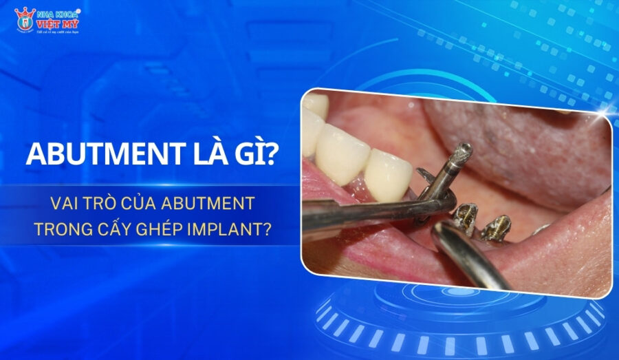 thumbnail abutment là gì