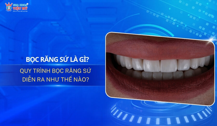 Thumbnail bọc răng sứ là gì