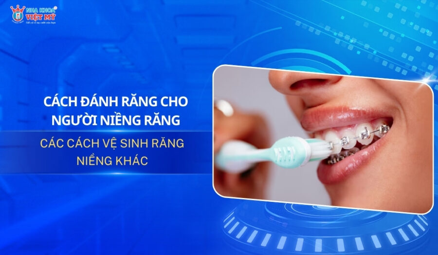 Thumbnail cách đánh răng cho người niềng răng