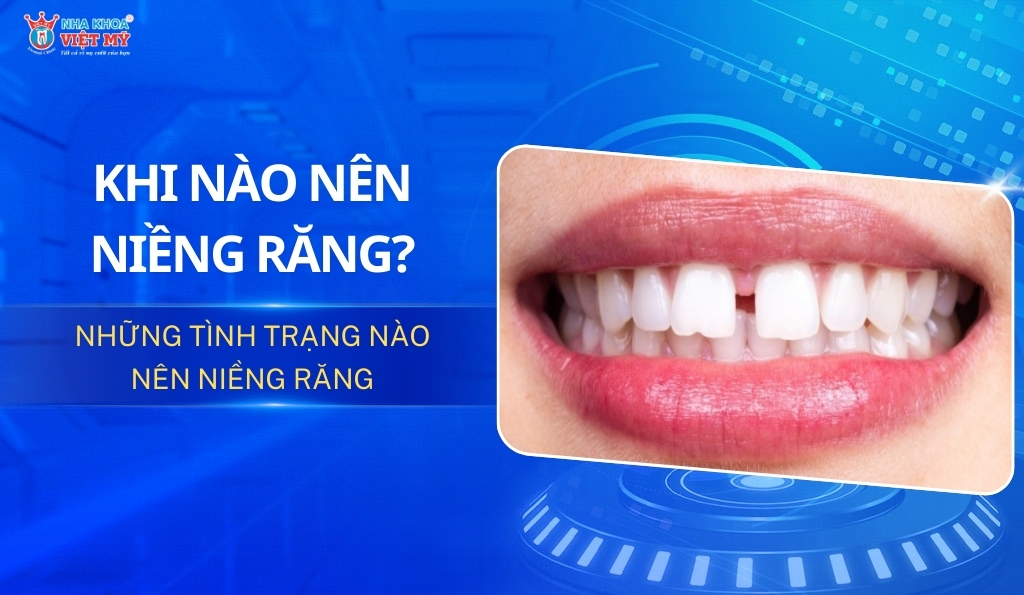 thumbnail khi nào nên niềng răng