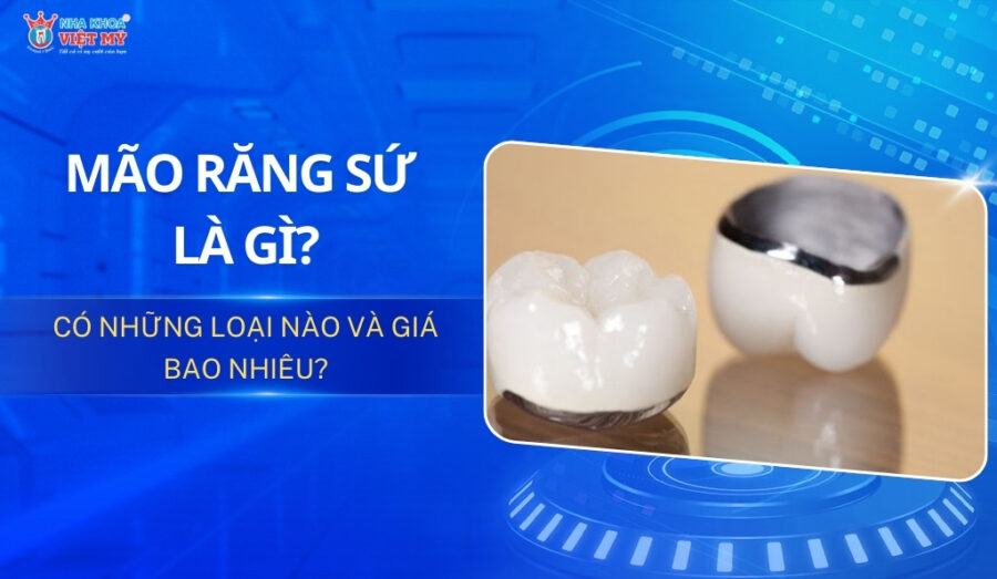 thumbnail mão răng sứ là gì