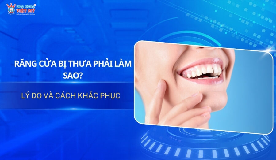 Thumbnail răng cửa bị thưa phải làm sao