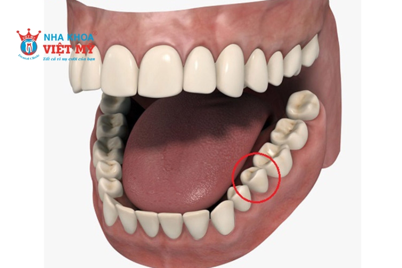 Răng số 5 đóng vai trò hỗ trợ răng hàm nghiền thức ăn một cách hiệu quả