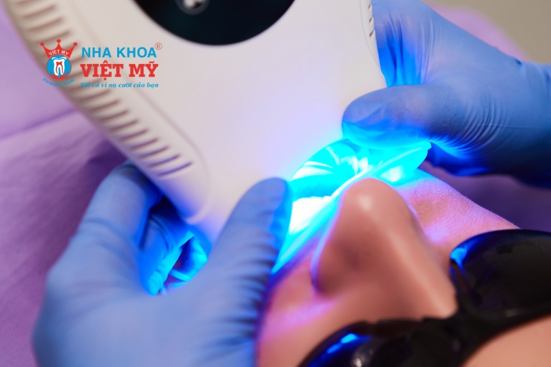 Tẩy trắng răng bằng laser whitening có nhiều ưu điểm vượt trội