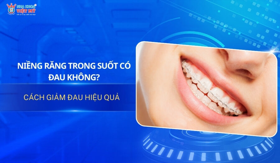 Thumbnail niềng răng trong suốt có đau không