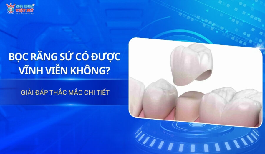 Bọc răng sứ có được vĩnh viễn không?