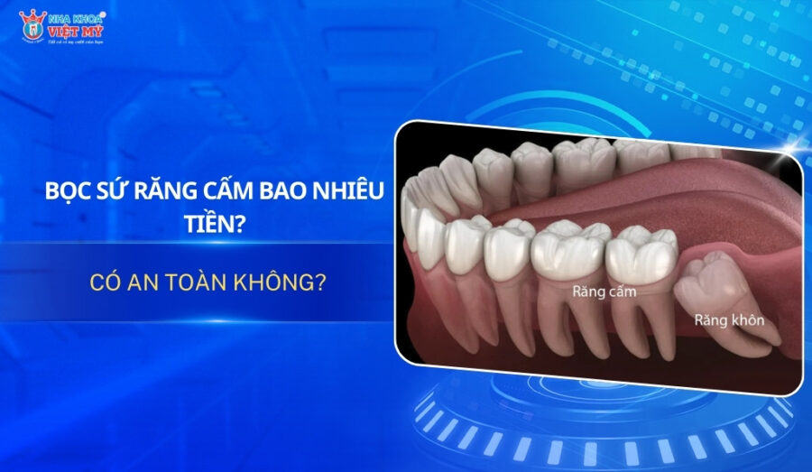 bọc sứ răng cấm bao nhiêu tiền