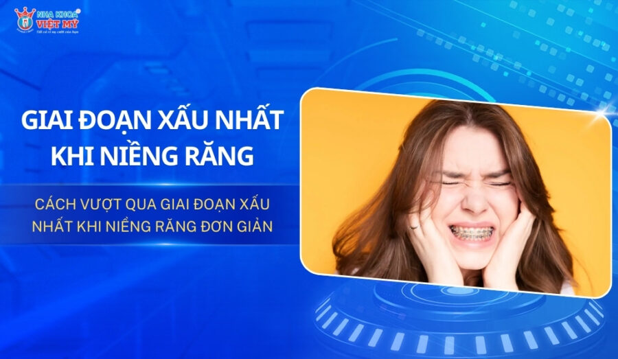 thumbnail giai đoạn xấu nhất khi niềng răng