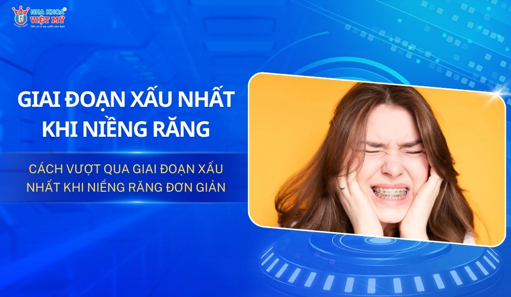 thumbnail giai đoạn xấu nhất khi niềng răng