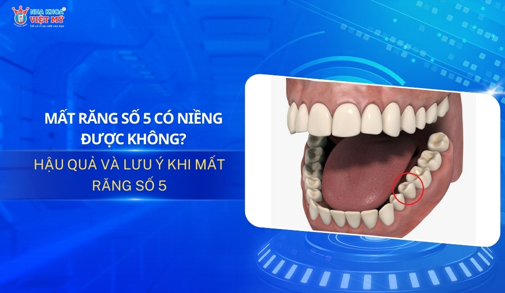 Thumbnail mất răng số 5 có niềng được không