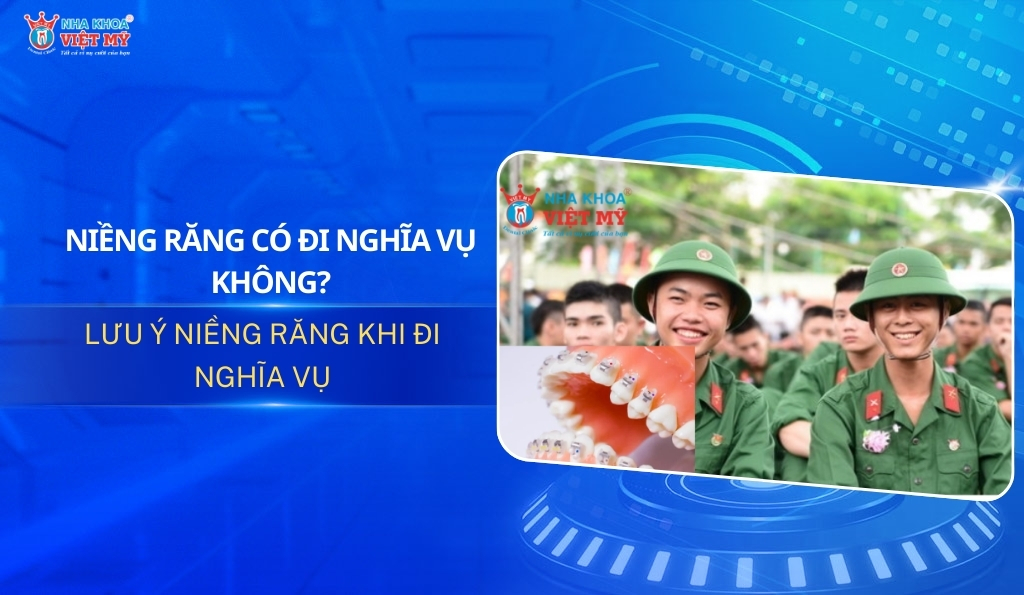 thumbnail niềng răng có đi nghĩa vụ không