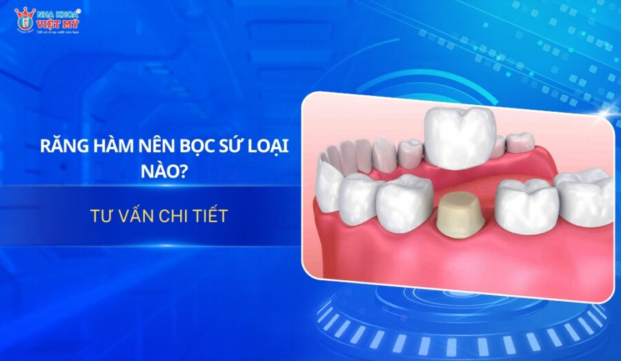 thumbnail răng hàm nên bọc sứ loại nào