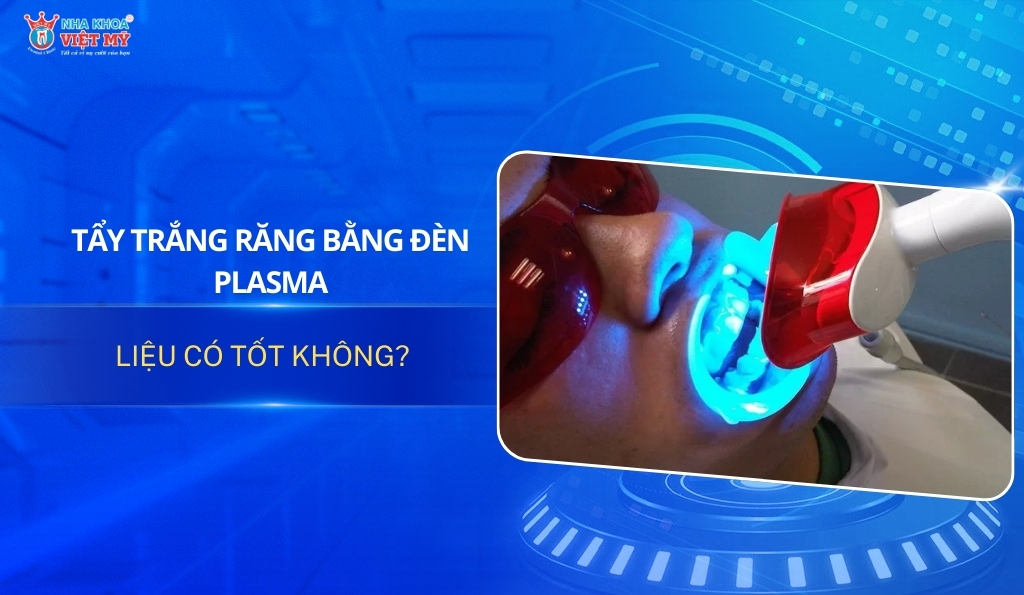 Thumbnail tẩy trắng răng bằng đèn plasma