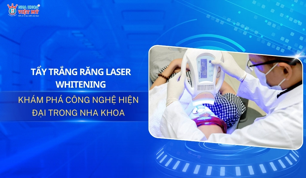 thumbnail tẩy trắng răng laser whitening