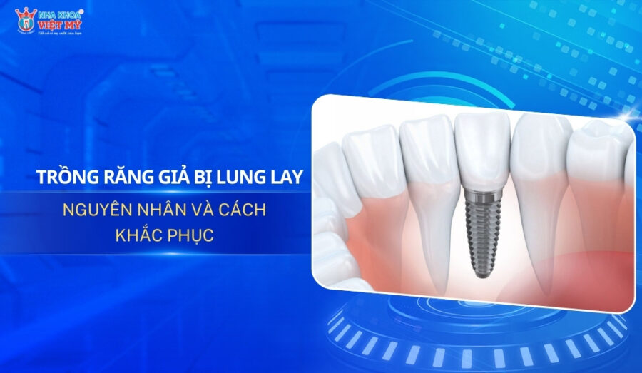 thumbnail trồng răng giả bị lung lay