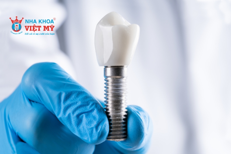 Giá trụ Implant Hiossen tùy thuộc chính sách mỗi nha khoa