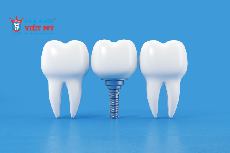 Trồng răng Implant mang lại tự tin, khả năng ăn nhai tốt