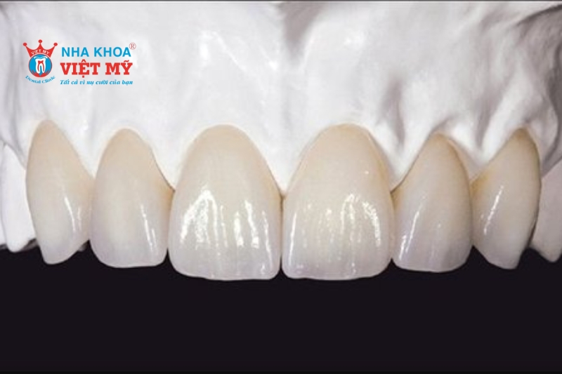 Có thể chọn răng sứ Zirconia thay thế cho răng sứ kim loại