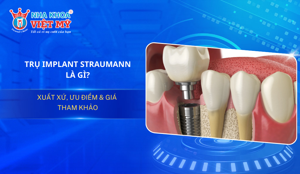 Trụ Implant Straumann là gì? Xuất xứ, ưu điểm & giá tham khảo