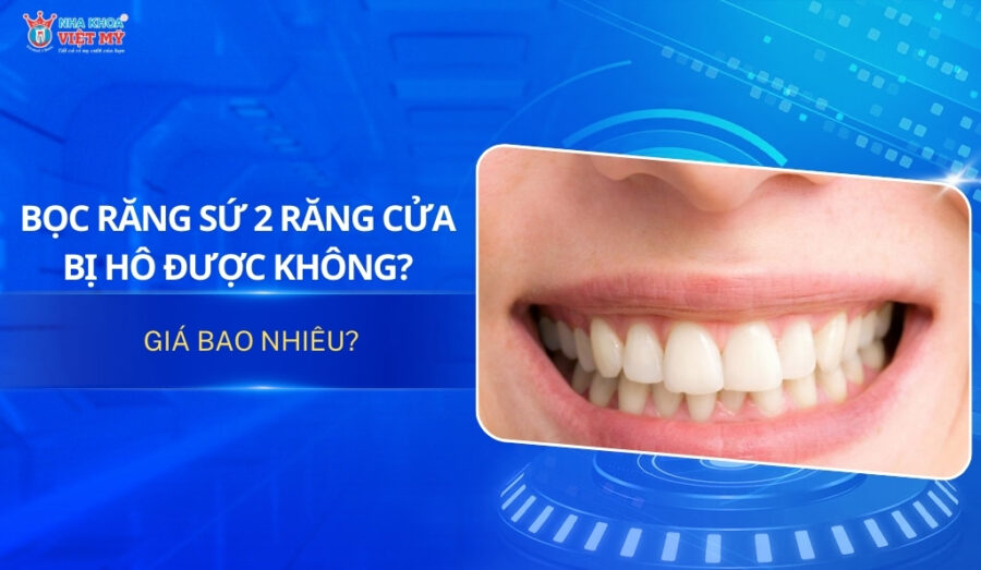 thumbnail bọc răng sứ 2 răng cửa bị hô