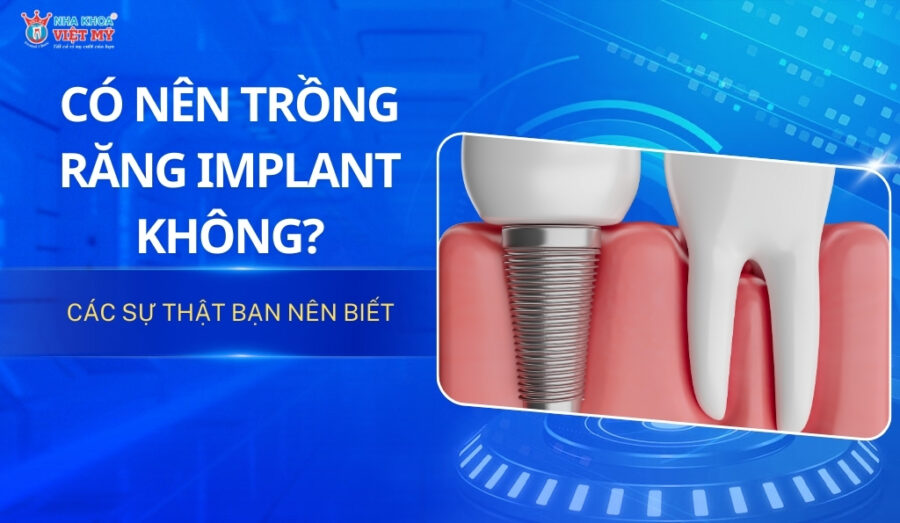 thumbnail có nên trồng răng implant không