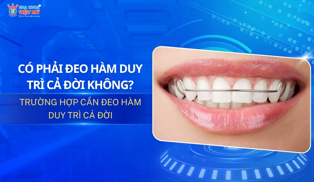 thumbnail có phải đeo hàm duy trì cả đời không