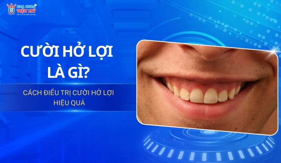 Cười hở lợi là gì? Cách điều trị cười hở lợi hiệu quả