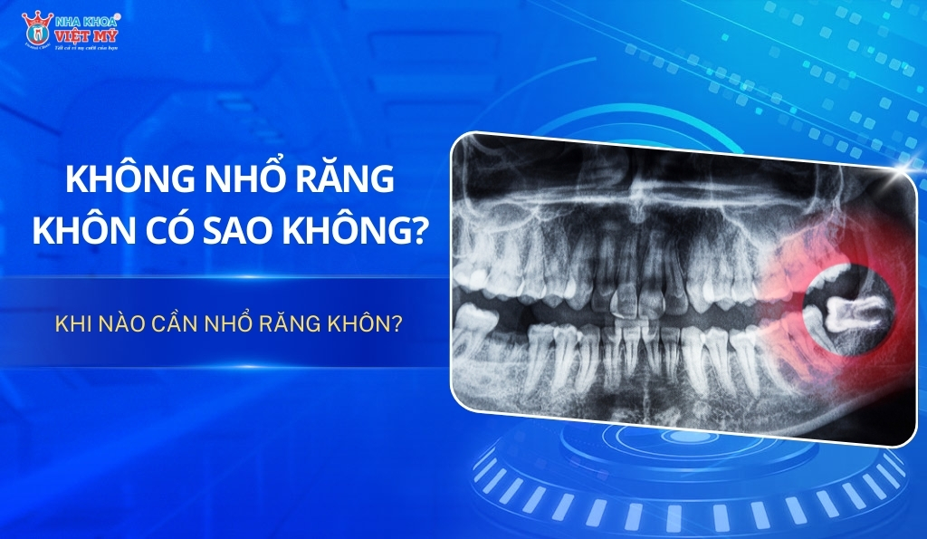 Không nhổ răng khôn có sao không? Khi nào cần nhổ?