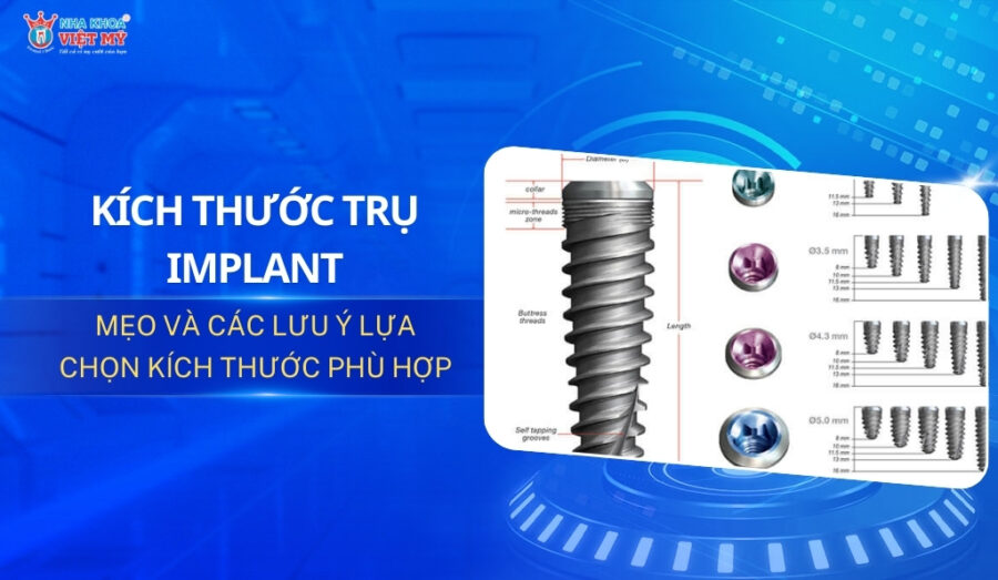 thumbnail kích thước trụ implant