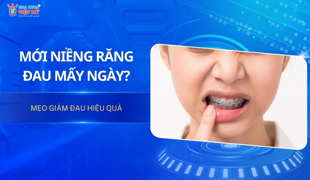 Mới niềng răng đau mấy ngày? Mẹo giảm đau hiệu quả