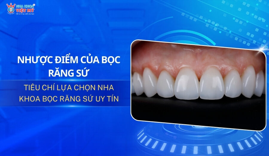 thumbnail nhược điểm của việc bọc răng sứ