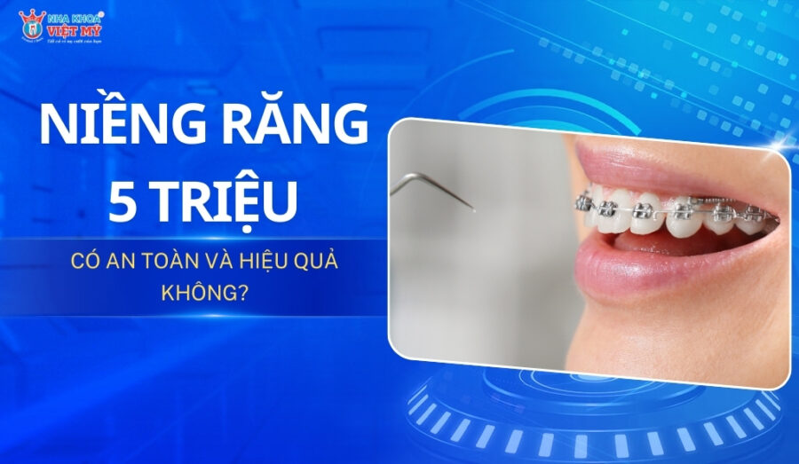 thumbnail niềng răng 5 triệu