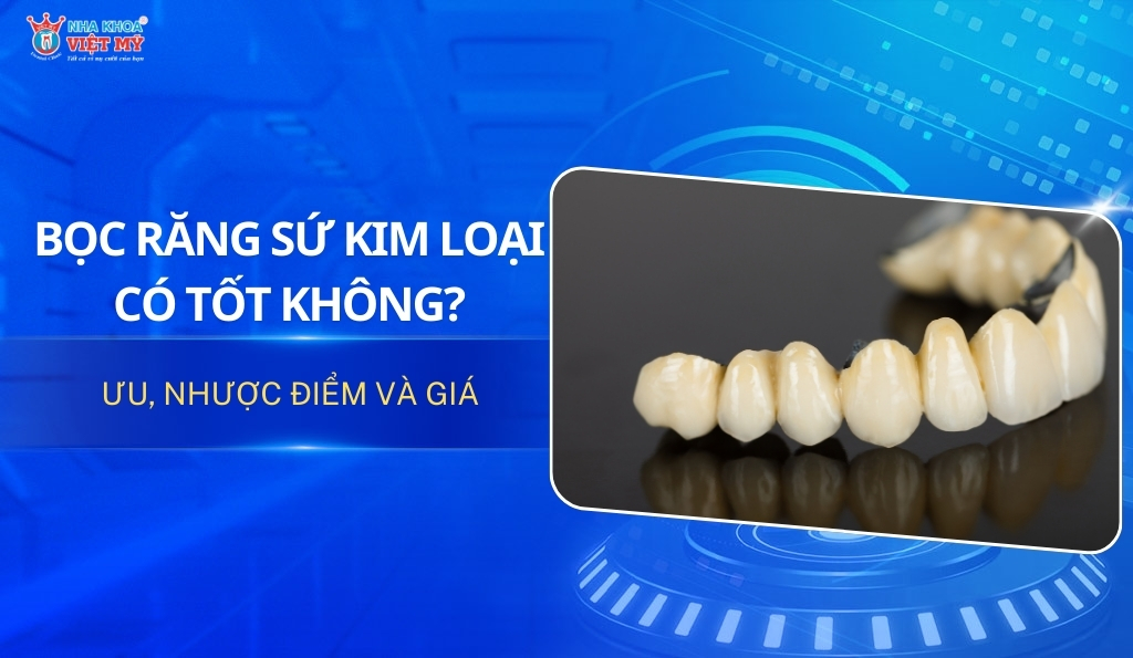 thumbnail răng sứ kim loại có tốt không